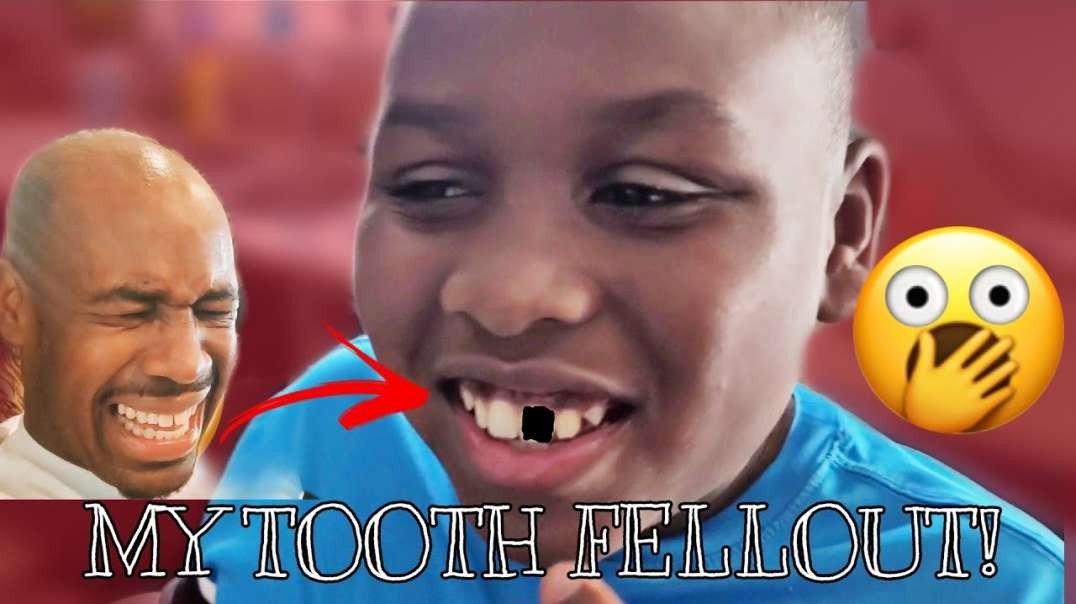 ⁣My tooth FELL OUT during Kitchen Accident