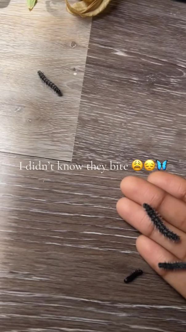 They bit me 😩